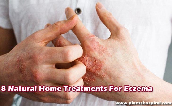 Home-treatments-for-eczema