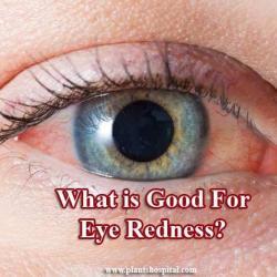 eye redness