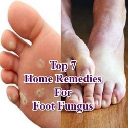 foot fungus