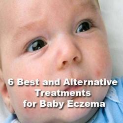 baby eczema