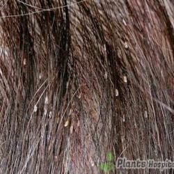 lice
