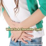 Chocolate-Cyst