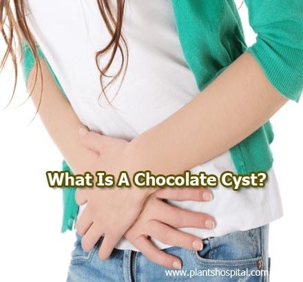 Chocolate-Cyst
